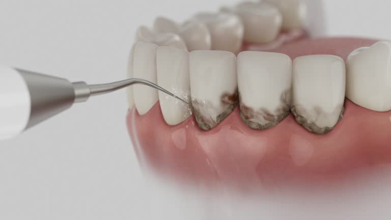 Reliable Dental Implants contractor in Wauchula, FL by Smile Center Dentistry